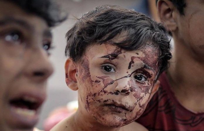 Colombia acogerá a niños palestinos heridos por conflicto en Gaza y a sus familias