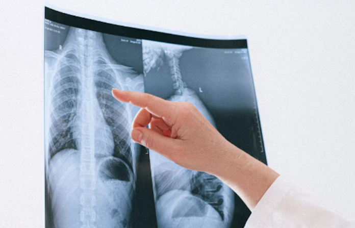 Científicos colombianos descubren cómo ayudar a 64 millones de pacientes con una enfermedad sin cura