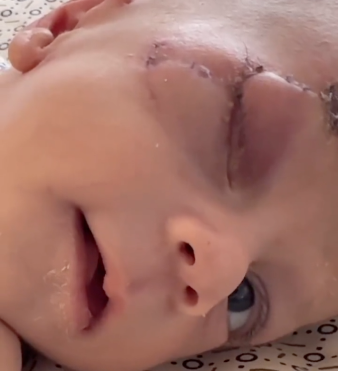 La OMS registra más de 400 ataques contra instalaciones sanitarias desde el 7 de octubre