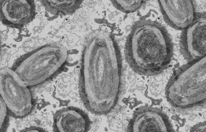 Enfermedad X: ¿México está preparado para una posible pandemia más mortífera que el COVID-19?
