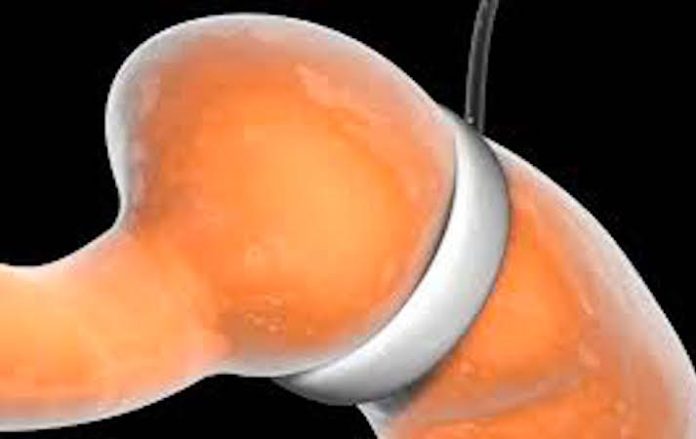 Daniela Puente pide difusión sobre los riesgos a largo plazo de cirugías bariátricas