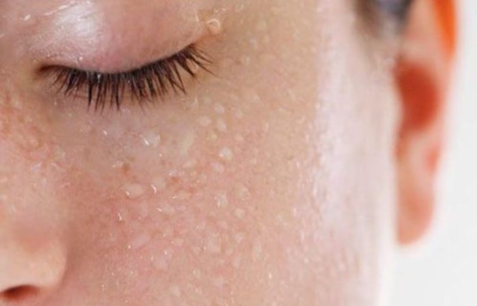 ¿Qué es la hiperhidrosis facial?