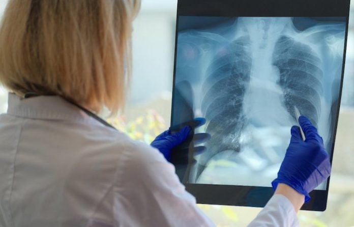 Proponen blindar tratamientos contra el cáncer ante fallas del sistema público