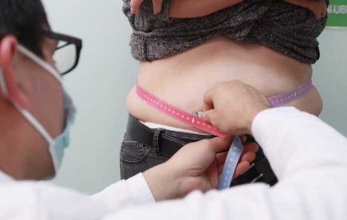 Confirman el número de personas que padecen obesidad en todo el mundo