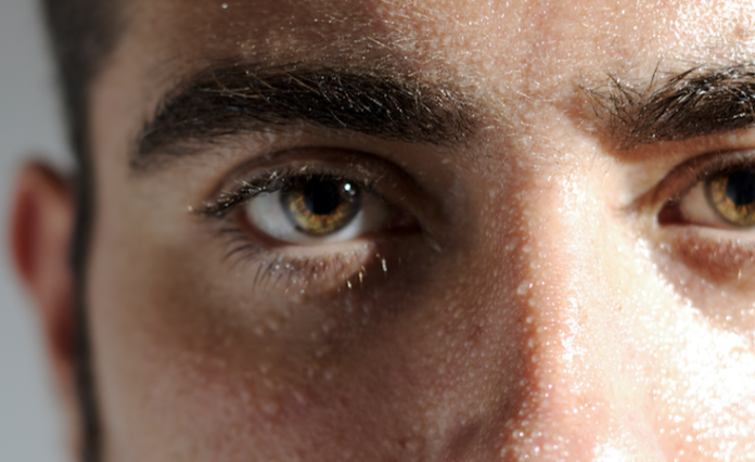 Cómo tratar la sudoración excesiva de la cara