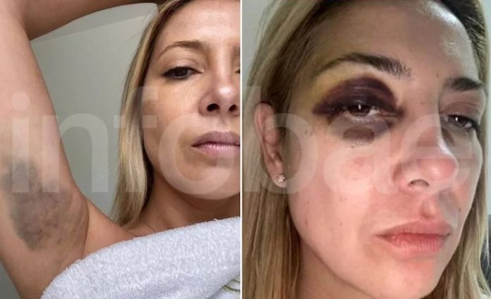 Expresidente argentino es citado a indagatoria el 11 de diciembre por violencia de género