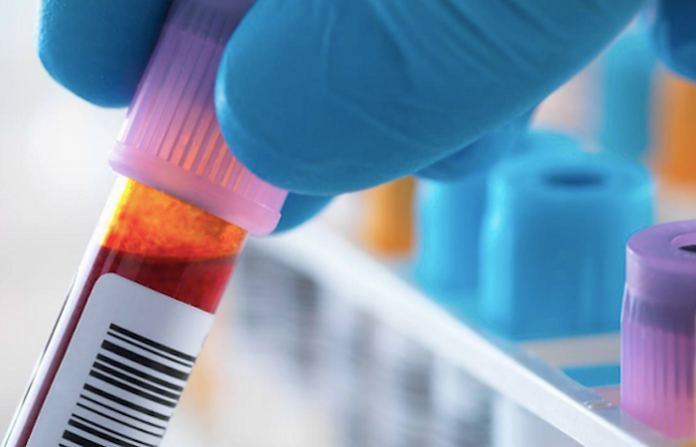 Piden que laboratorios avisen a autoridades sanitarias de enfermedades que puedan afectar a la población