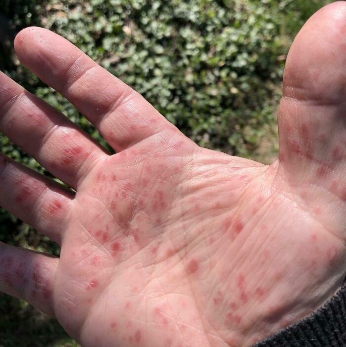 Declaran emergencia por un brote de fiebre aftosa en el sur de Eslovaquia