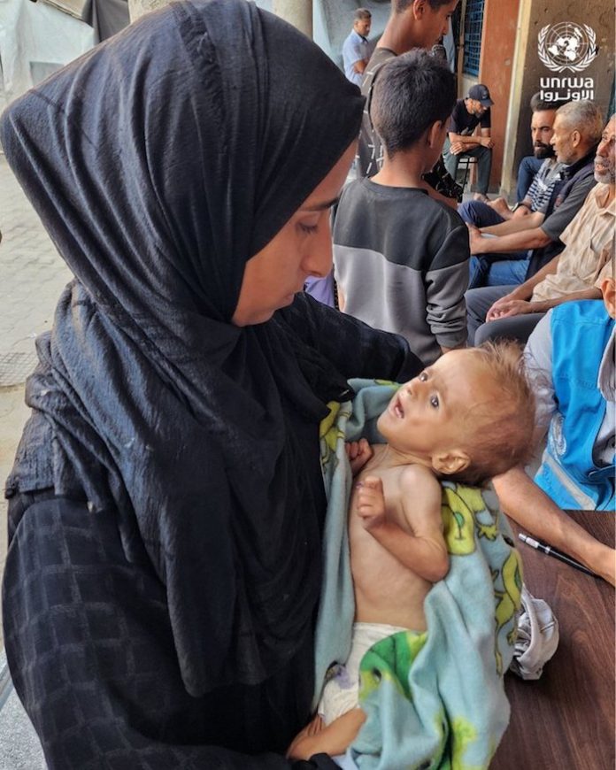 “Es un desastre absoluto”: Trump indica que los niños en Gaza parecen muy hambrientos, al contrario de las palabras de Netanyahu