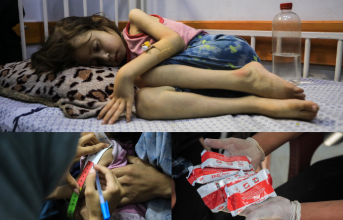 Más de 26.000 niños de la Franja de Gaza requieren tratamiento por desnutrición aguda
