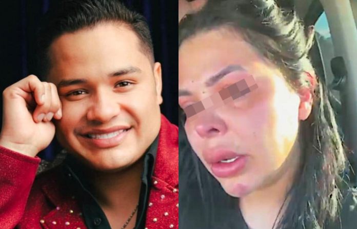 Video: Esposa del vocalista de “Los Recoditos” denuncia agresiones; la banda anuncia pausa temporal del cantante