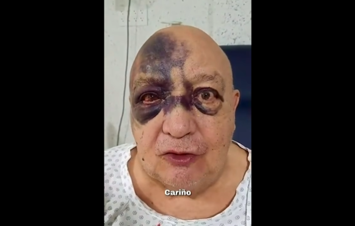 “¡Estoy bien!”: Luis de Alba rompe el silencio y tranquiliza a sus seguidores tras video viral