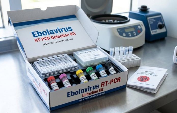 Rusia entrega a países africanos más de 7.000 kits de diagnóstico del ébola
